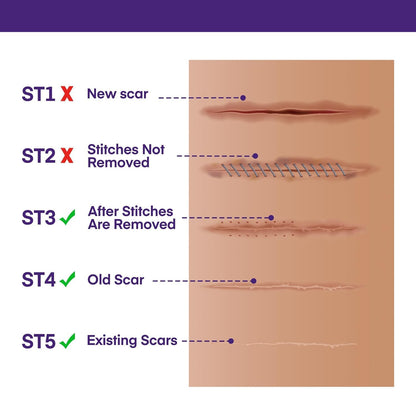 Silicone Scar Gel Scar Cream - SPF 30 Advanced Scar Gel for Old and New Scars 🍁 All In One Marketplace Canada