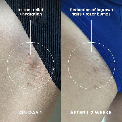 Bushbalm Ingrown Hair Exfoliating Scrub - Reduces Appearance of Ingrown Hairs and Razor Bumps, Soothes Skin and Post-Shave Redness - Nude, 236 ml 🍁 All In One Marketplace Canada
