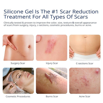 100% Silicone Scar Gel Scar Cream - Advanced Scar Gel for Old and New Scars 🍁 All In One Marketplace Canada