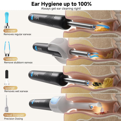 Bebird Ear Wax Removal Tools, Bebird Ear Cleaner, 1080P HD Endoscope, Wireless Earwax Removal Tools with 6 LED Lights, Compatible with iPhone & Android and Kids, Adults (Black) 🍁 All In One Marketplace Canada