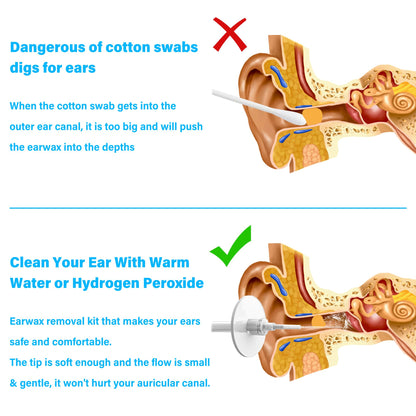 TopQuaFocus 500ml Earwax Remover Ear Cleaner Irrigation Tool Ear wax Removal Flushing System Earwax Cleaning Spray Bottles Ear Flush System for Adults & Kids (16.9oz) 🍁 All In One Marketplace Canada