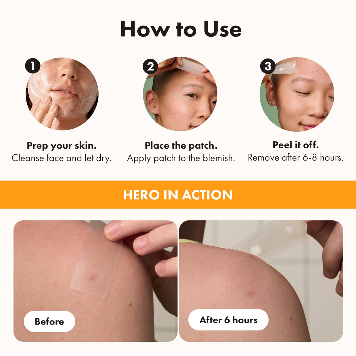 Hero Cosmetics Mighty Patch Surface – Large Hydrocolloid Patch for Pimples on the Body, Back and Face, Suitable for Sensitive Skin, 10 Count 🍁 All In One Marketplace Canada