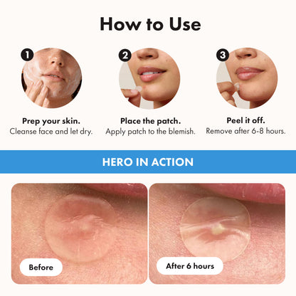 Hero Cosmetics Mighty Patch Invisible+ – Barely-there Hydrocolloid Patch for Pimples on the Face, Day-time Patches for Sensitive Skin, 39 Count 🍁 All In One Marketplace Canada