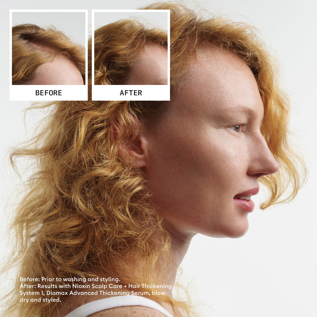 Nioxin System 4 Scalp + Hair Shampoo - Hair Thickening Shampoo For Damaged Hair with Progressed Thinning, 16.9 fl oz (Packaging May Vary) 🍁 All In One Marketplace Canada