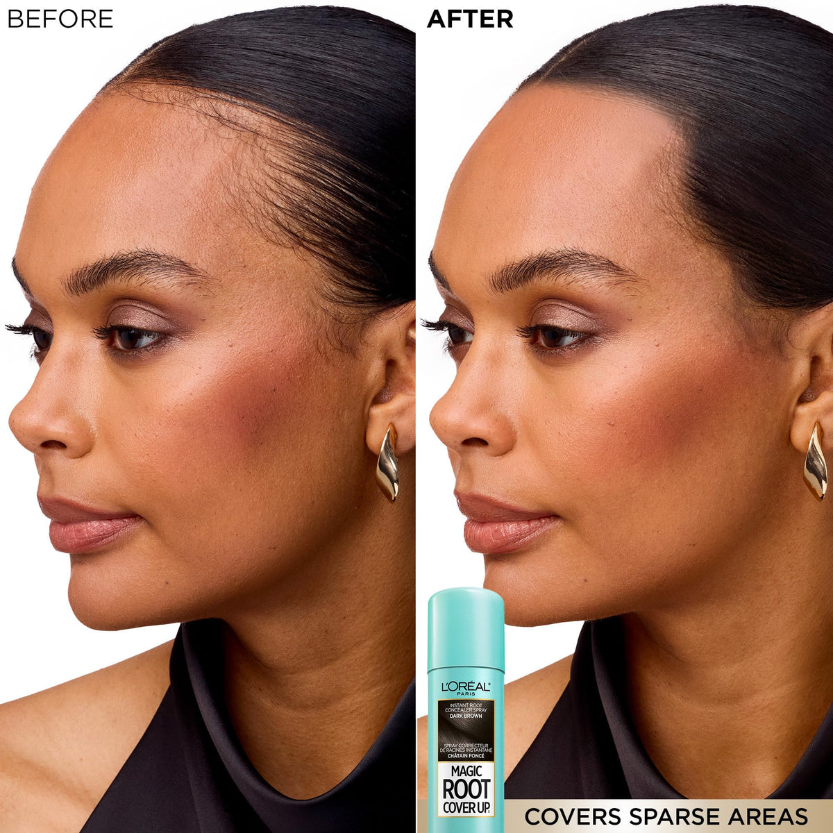 L'Oréal Paris Magic Root Cover Up Root Touch Up, Medium Brown Blonde Hair Dye, Root Touch Up Spray for Thinning Hair, Temporary Hair Dye, Grey Coverage, Pack of 2 🍁 All In One Marketplace Canada